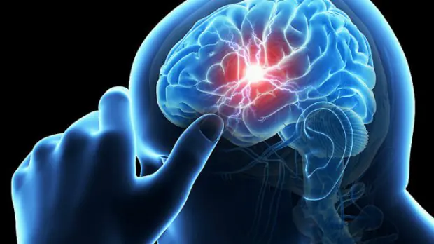 Medicii avertizează: Persoanele cu această grupă de sânge riscă un AVC înainte de 60 de ani!