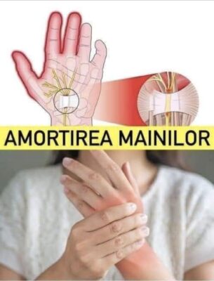 Dacă te trezești cu MÂINILE amorțite, corpul tău îți transmite acest SEMNAL…