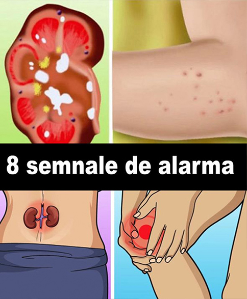 Dacă ai fața UMFLATĂ, acesta este SEMNUL că RINICHII…