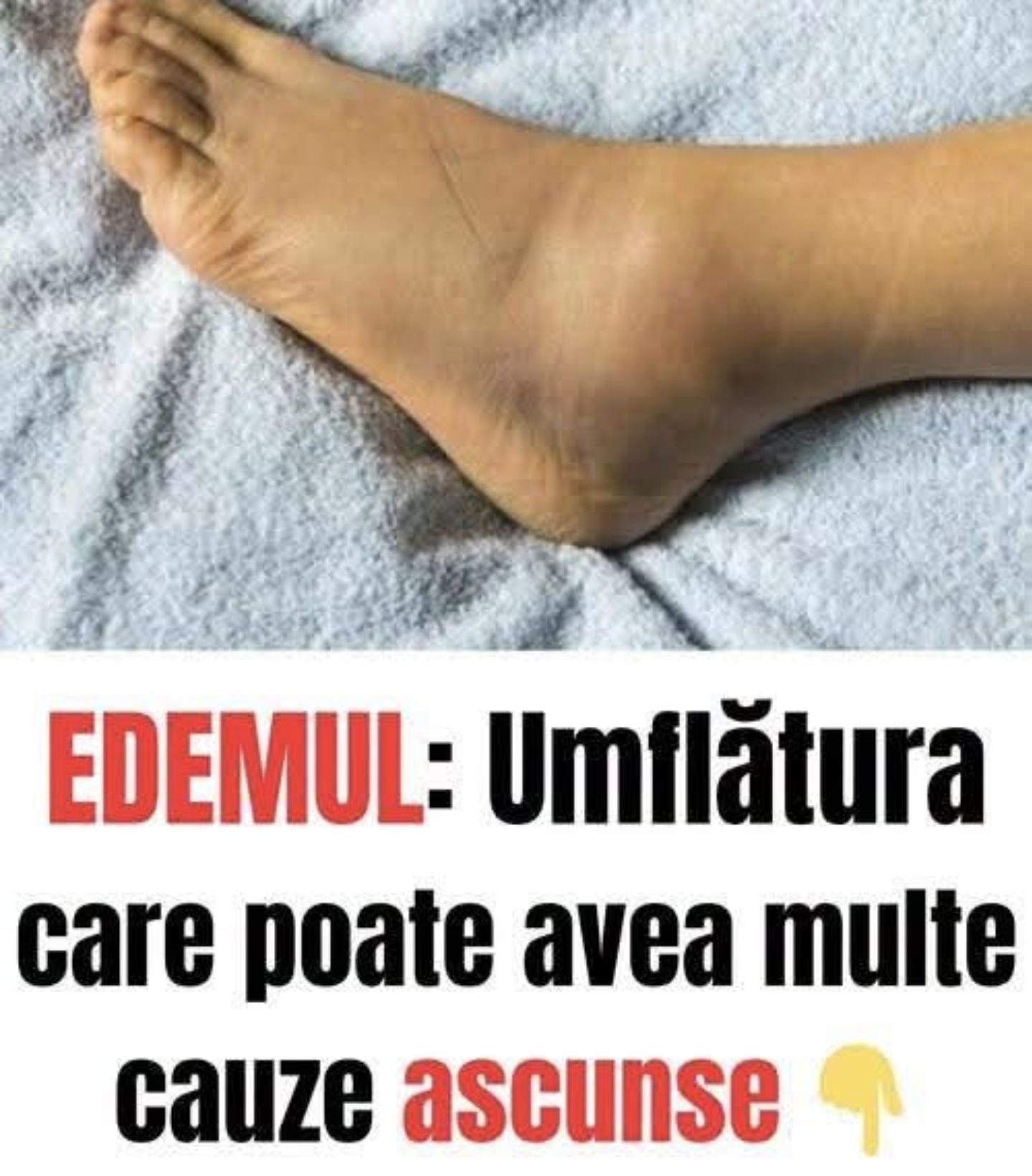 Ai o singură gleznă umflată? Iată motivul pentru care trebuie să mergi URGENT…