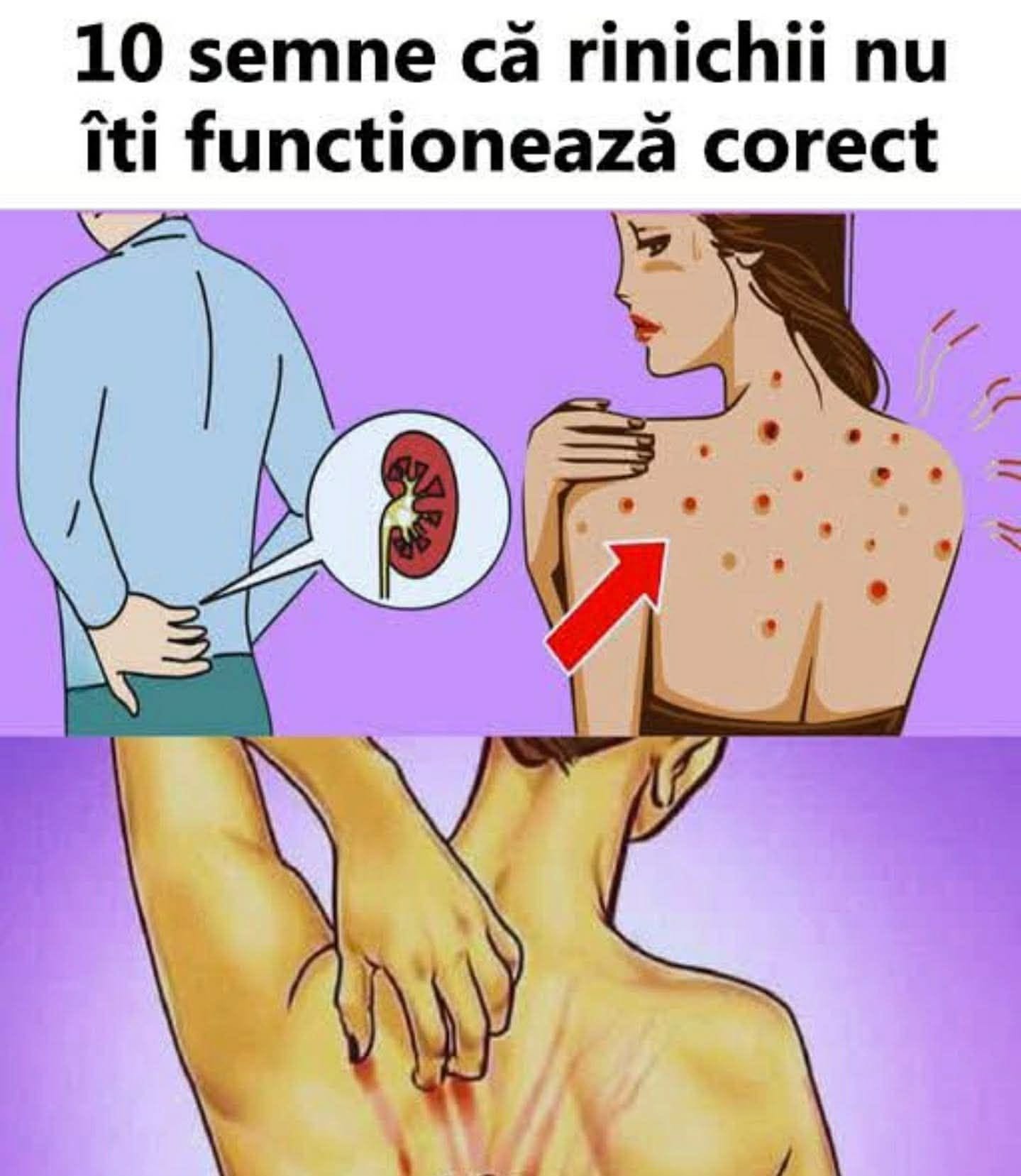 Aceste SEMNE subtile îți arată că rinichii tăi sunt în mare pericol…